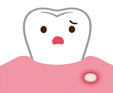 歯根が膿む??歯の神経を取るとどうなるの?